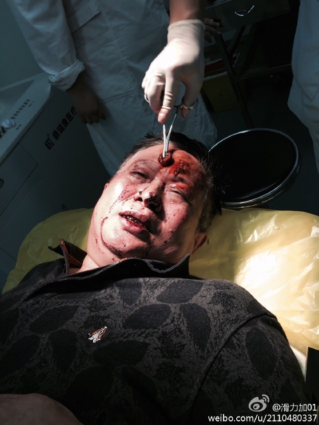 关于呼市1022雇凶杀人案致中纪委公安部公开