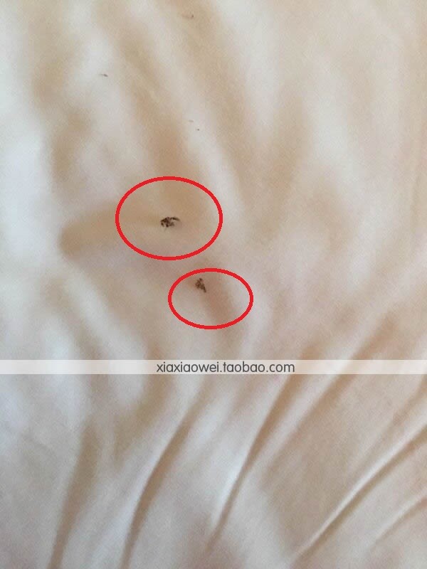 『四月团购VS不作死不会死的发际线植发手术