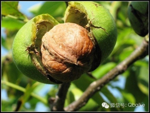 <em>妇女生孩子</em>在坐月子时落下的所有病根都能根治