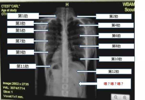 没法好好看韩剧了:从宋慧乔看的X光片里,能发