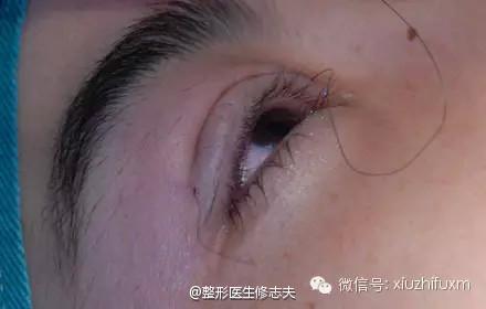 58f98a2fe970efedf59d77a9bad3d8f2_440_280.jpg