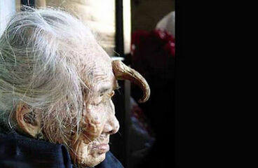 揭秘头上长角的怪人:妇女角长达17厘米