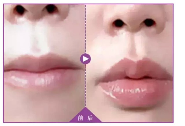 怎么让自己的五官变得立体 6b7b0f9183f8f8eb19b2ae0a2960cdc1_900_614.jpg