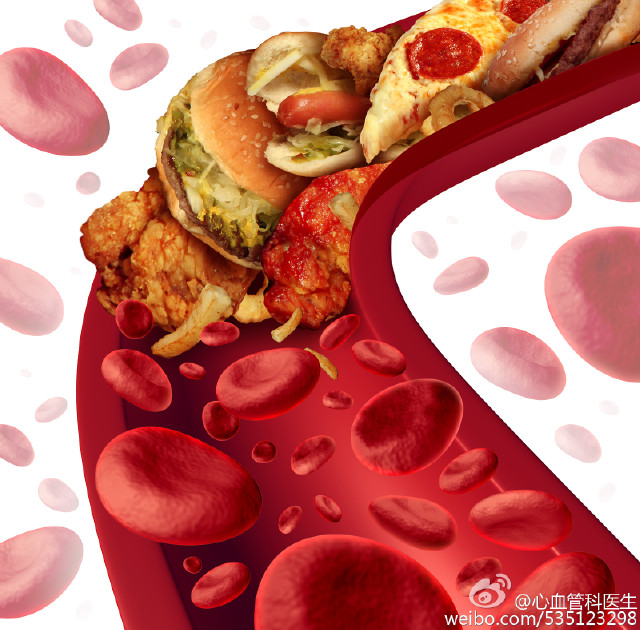 一步之遥--高胆固醇血症与冠心病