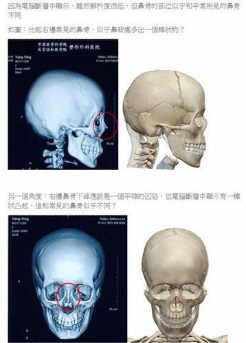 专家质疑杨颖面部鉴定结果:是不是本人的?