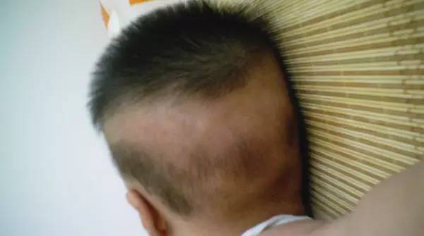 OMG,<em>宝宝</em>睡成小秃子了--枕秃的解决方法_新浪