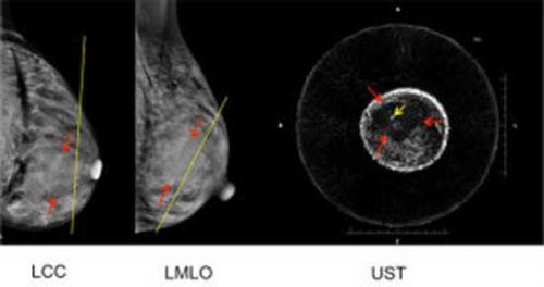 猫伙呆:超声波成像乳癌检测仪-数字出版在线