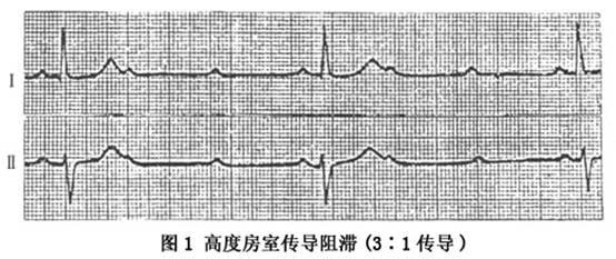 c614fd6e72f892cb5809362505781366_554_233.jpg