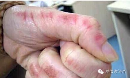 女人,真的不能再手洗衣服了!真相真是好吓人~(转给你爱的人!!)