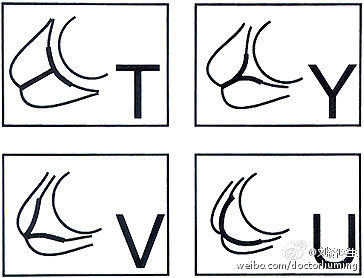 宫颈长度与宫颈机能不全