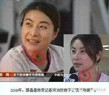 颈间有吻痕？舒淇大大，你只是想验证吻死人是假新闻对不对？
