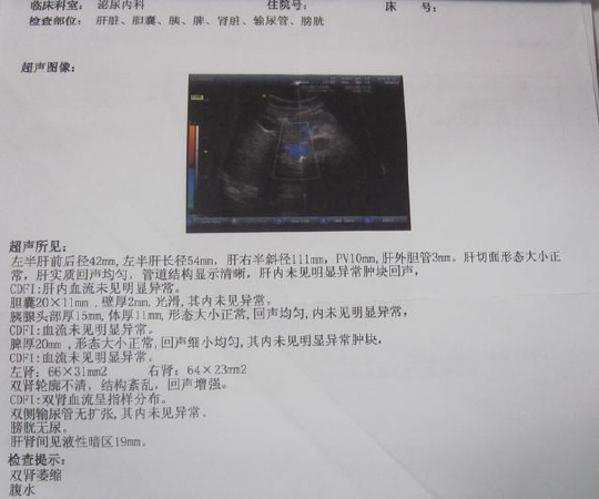 教你轻松看懂肝脏B超报告