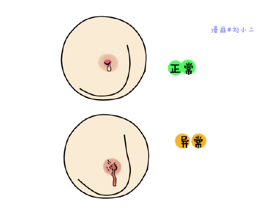 女人怀孕后咪咪会经历的3个奇妙变化