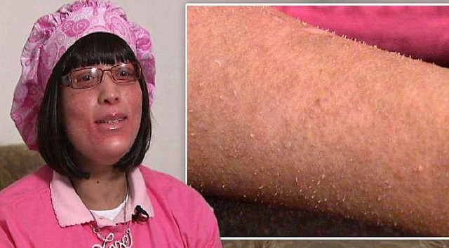 美女子全身皮肤长指甲