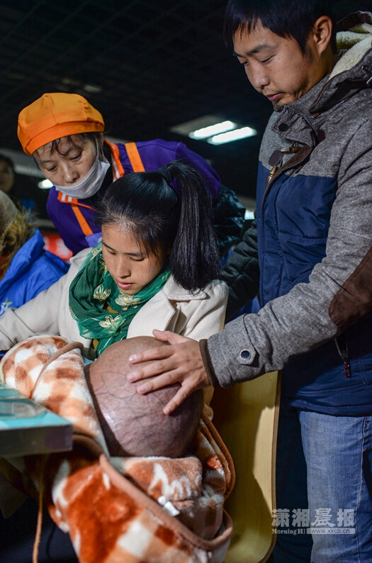 孩子患病成"大头娃娃" 为省钱一家人住车里