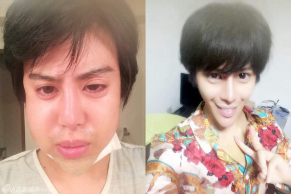 日整形狂人整成真蛇精